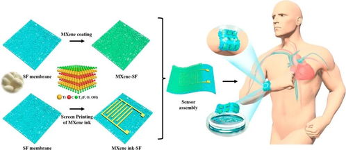 北化张立群 万鹏博教授 透气 可降解 超灵敏mxene蛋白质基医用压力传感器